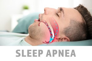 Man with narrowed airway suffering from sleep apnea in Eugene