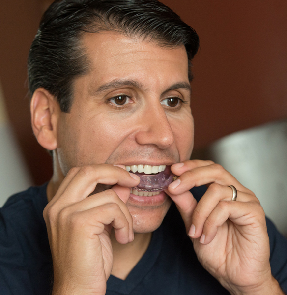 Man placing purple sleep apnea oral appliance into his mouth