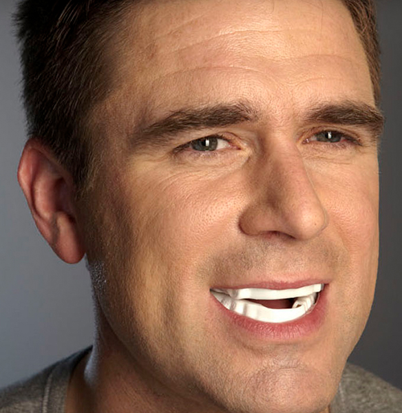 Man wearing a white oral appliance over his teeth