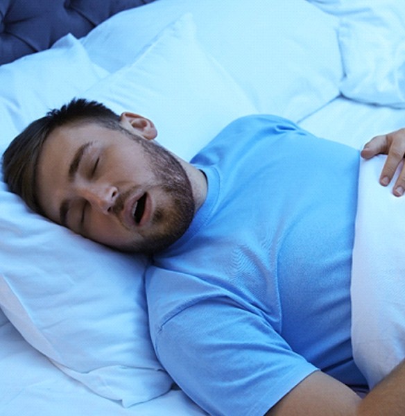 Man with sleep apnea snoring in bed