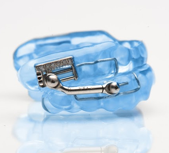 Herbst light blue oral appliance